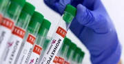 Karnataka reports first Mpox case this year as 40-year-old Dubai returnee tests positive Karnataka reports first Mpox case this year as 40-year-old Dubai returnee tests positive